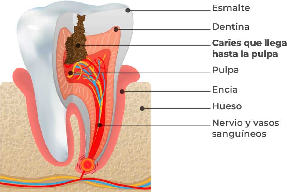 estructura-de-un-diente-endodoncia estructura-de-un-diente-endodoncia