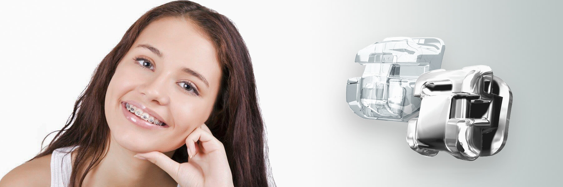 ortodoncia-brackets-barcelona ortodoncia-brackets-barcelona