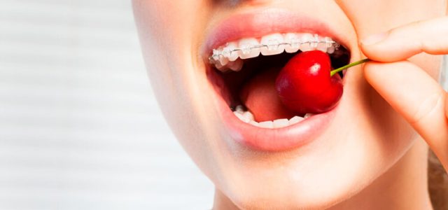 que-no-comer-con-brackets