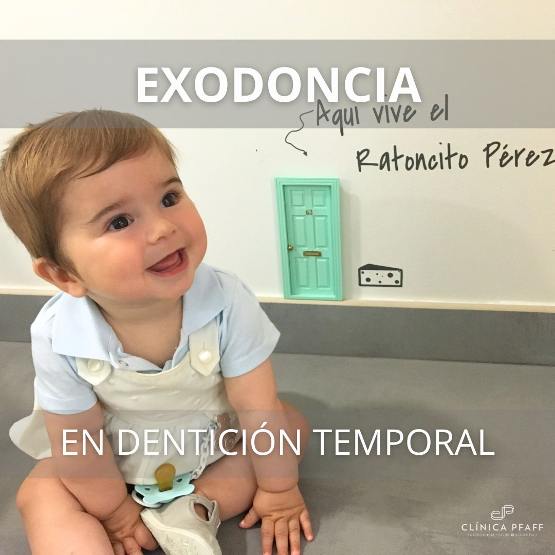 exodoncia-denticion-temporal-barcelona-clinica-pfaff